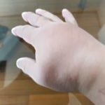 排出できない尿酸が暴れる日…僕が試した“逆アプローチ